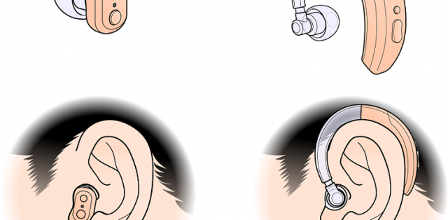 【医療機器の種類】<br>補聴器