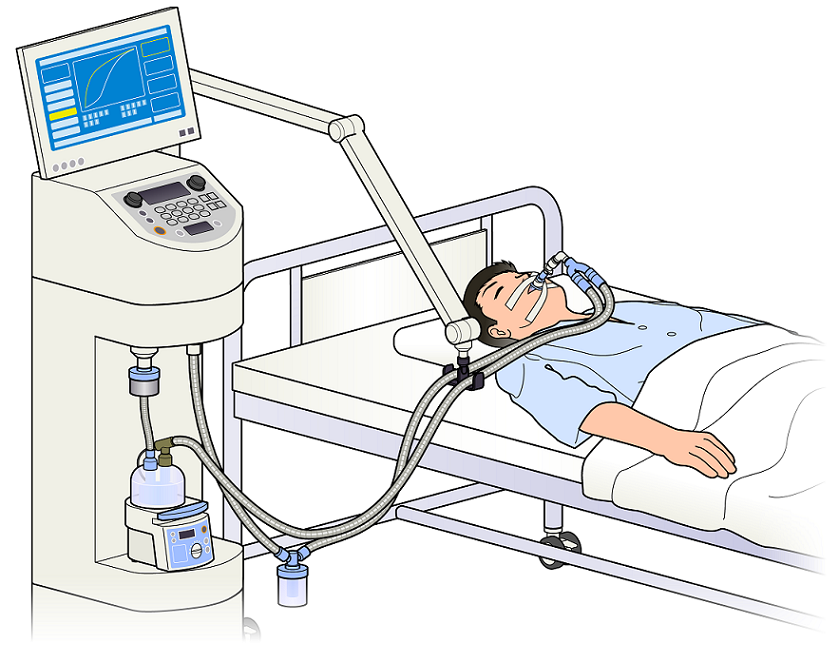 医療機器の種類 人工呼吸器 医機なび 就活生のための医療機器業界情報発信webマガジン