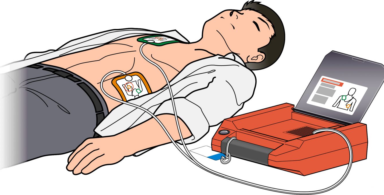 【医療機器の種類】<br>AED（自動体外式除細動器）