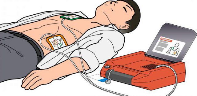 【医療機器の種類】<br>AED（自動体外式除細動器）