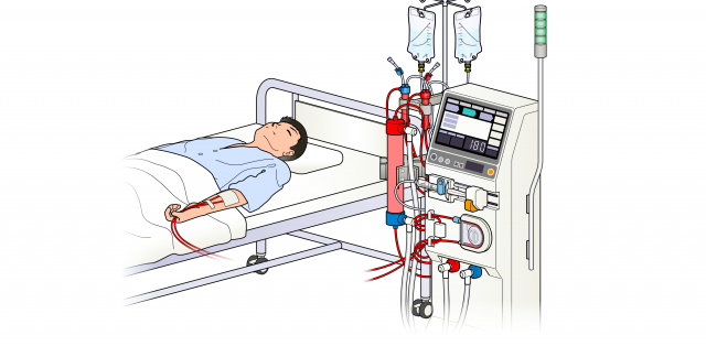 【医療機器の種類】<br>血液透析装置