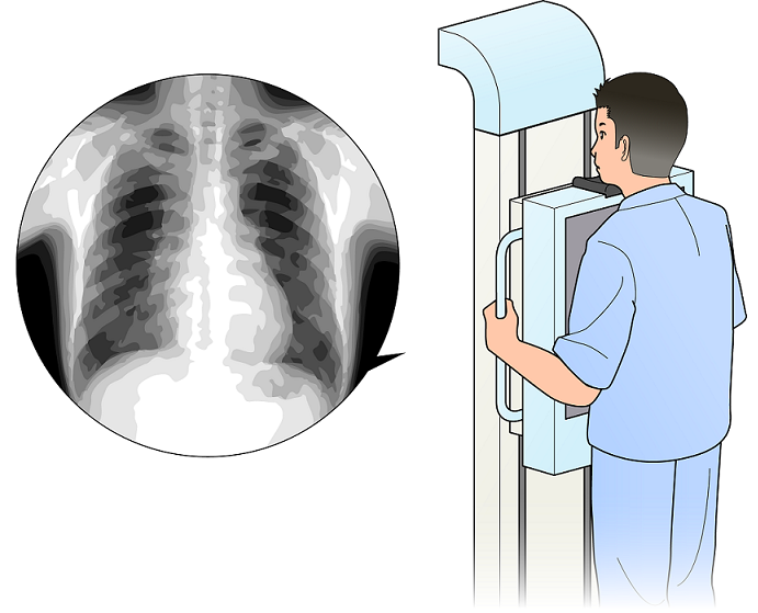 【医療機器の種類】<br>一般X線撮影装置