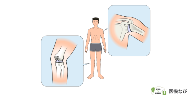 【医療機器の種類】<br>人工関節