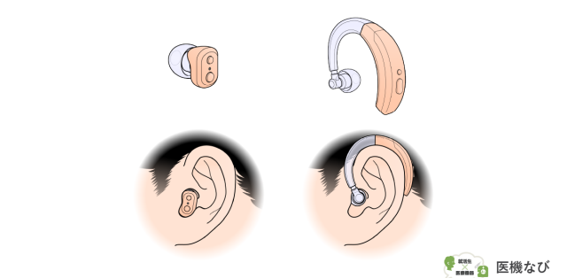 【医療機器の種類】<br>補聴器