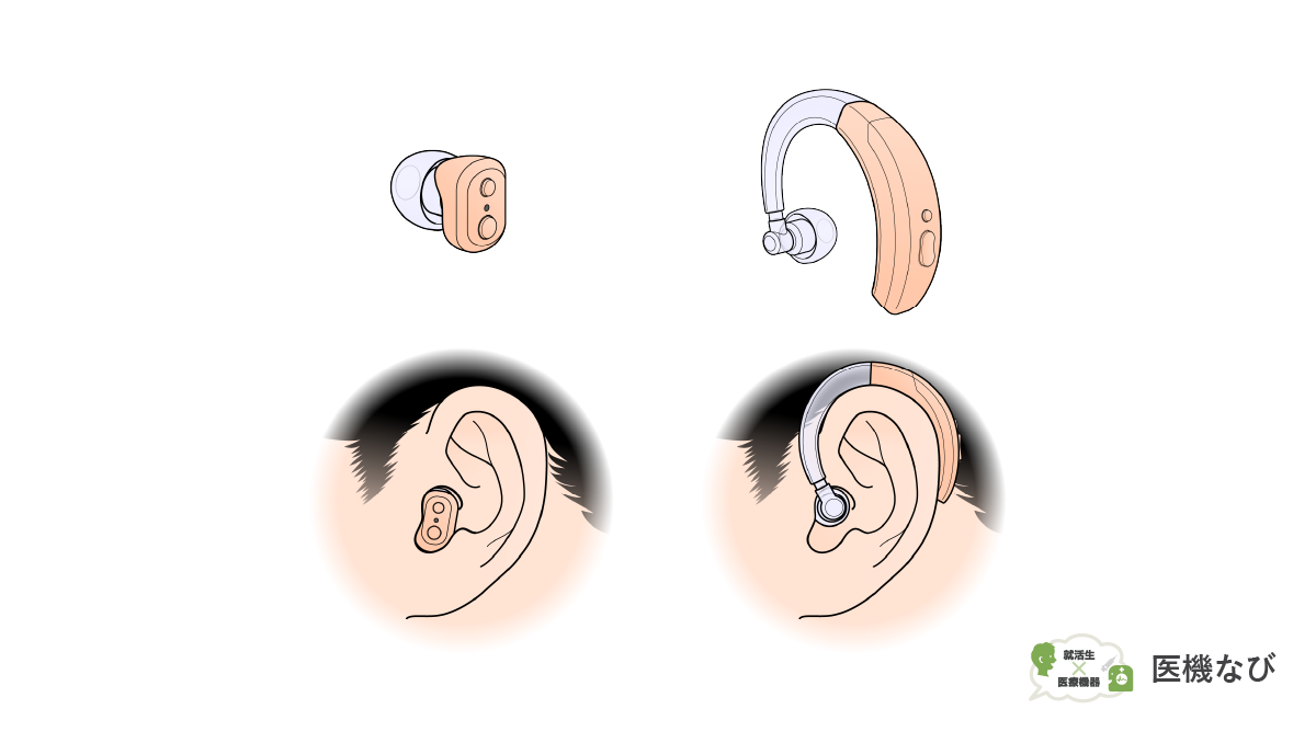 【医療機器の種類】<br>補聴器