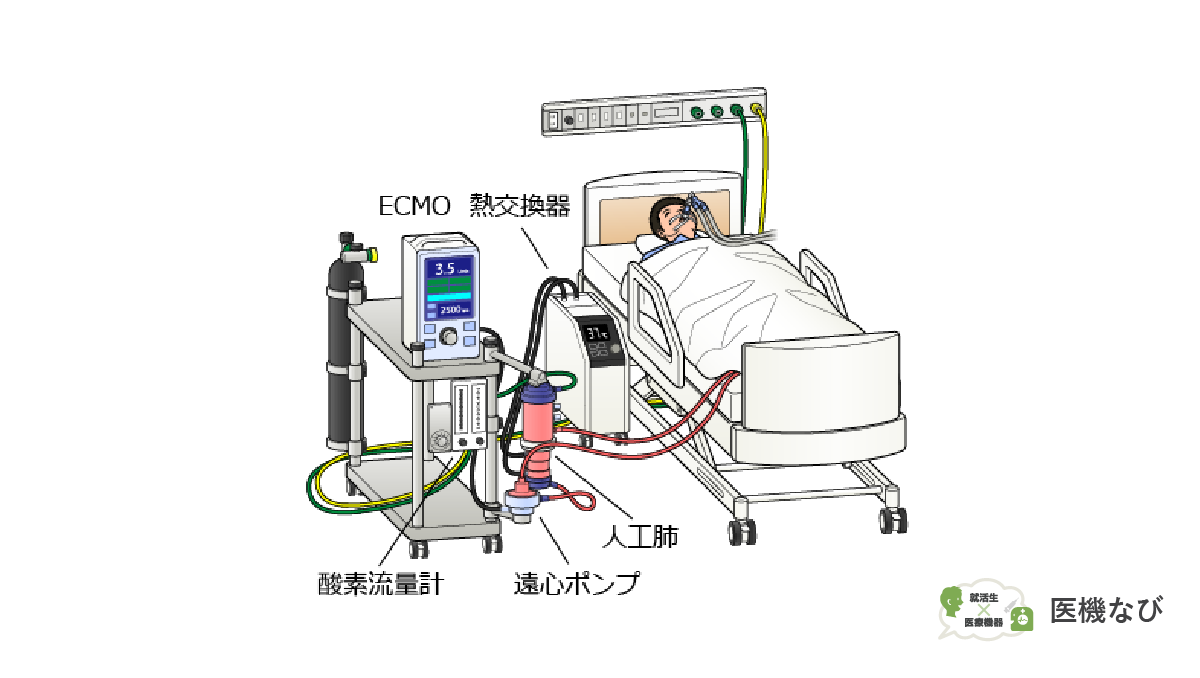 【医療機器の種類】<br>ECMO（Extracoporeal Membrane Oxygenation：体外式膜型人工肺）